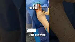 Knee Popping Fix - Patellar Clunk Syndrome Pre- vs. Postop #shorts