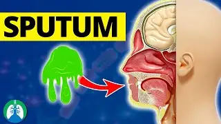 What is Sputum? *EXPLAINED*