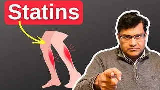 Can Statins cause muscle pain?(In one minute)