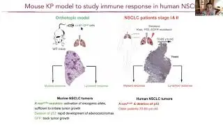 [María Casanova-Acebes] Tissue-resident macrophages provide a pro-tumorigenic niche to early NSCLC