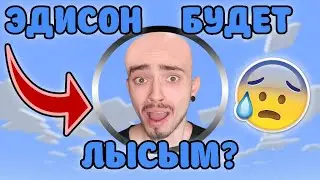 ЭДИСОН ПОБРЕЕТСЯ НАЛЫСО?!