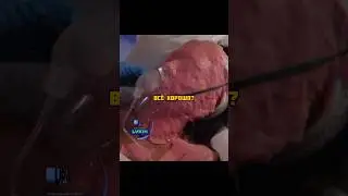 Всё её лицо покрылось воском😨 