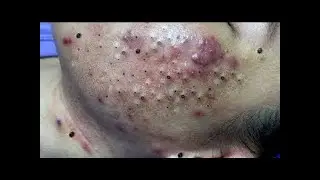 Extrusion of black dots. Relax video💥