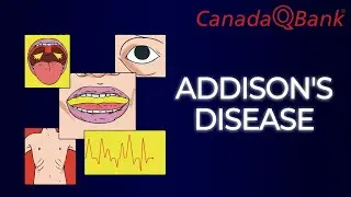 Addison Disease