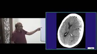 Revise 20000 Bullet Points in 10000 Minutes with Dr Murali Bharadwaz for NEETPG everyday 6pm 59