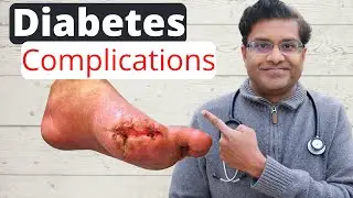 Complications of uncontrolled diabetes | 6 complications examined