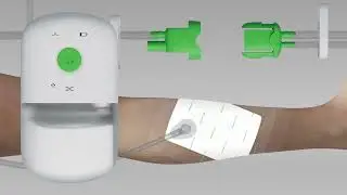 Avance Solo - Compressieverband aanbrengen