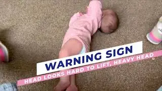 How to Help a Baby Who Can't Roll Over Because of a Heavy Head - For Proactive Parents