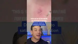 I thought it was just a cyst, then BOOM | 208SkinDoc