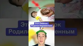 Этот Ребёнок Родился Беременным!😱 #shorts #ребенок #мама #беременность