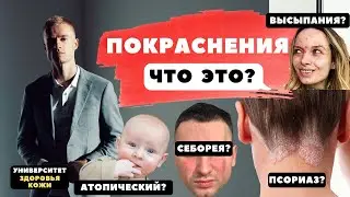 Покраснение на лице - что это может быть?