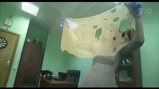 Врачи забыли кусок марли в теле женщины,после операции.