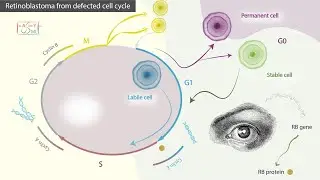 Retinoblastoma from defected cell cycle