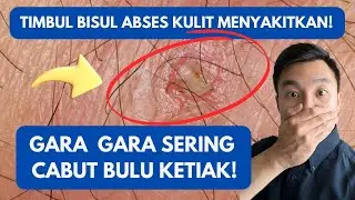 SERING CABUT BULU KETIAK? HATI HATI BISUL ABSES KULIT!