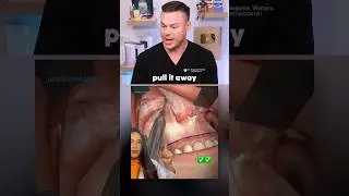 You Wont Believe What Really Happens In FACIAL SURGERY! 🪥🦷