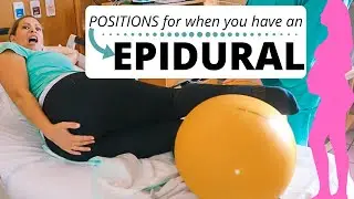 EPIDURAL | positions to speed things up!