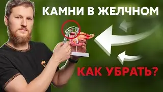 Камни в желчном пузыре - как убрать?