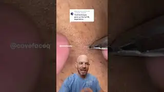 Clears out clogged pore in ONE satisfying pull👌#cloggedpores  #doctorreacts #satisfying #closeup