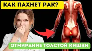 ТОЛСТАЯ КИШКА ОТМИРАЕТ! 90% людей даже НЕ ДОГАДЫВАЮТСЯ об этом