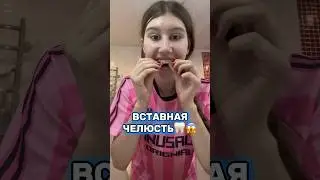 ВСТАВНАЯ ЧЕЛЮСТЬ