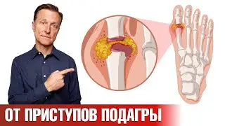 Средство №1 от приступов подагры, которое есть у каждого👍