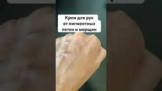 Крем для рук от пигментных пятен