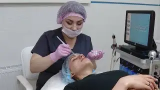 Косметология - как справиться с угревой болезнью (Крым) 26.04.2021