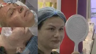 Последствия Уколов Красоты (синяки, пятна, отеки...)