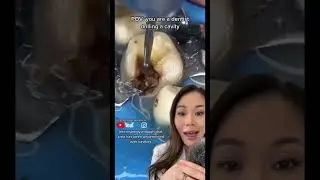 Dentist drills a massive cavity. 