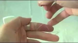 How To Remove Ring Easily From Finger