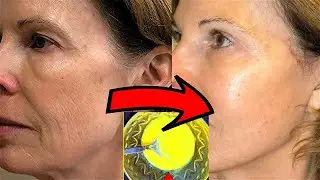 IT WILL TIGHTEN UP THE WHOLE FACE Even at 70 Years OLD ! Anti-wrinkle Face Mask