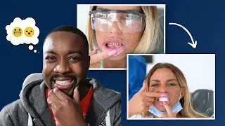 Katie Price: Teeth reconstruction, dentist reacts | Turkey teeth