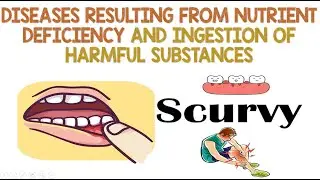 Diseases resulting from Nutrient Deficiency and Ingestion of Harmful Substances | Animation
