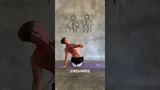Исправь сколиоз!