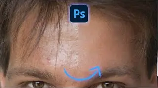 Removing Skin Blemishes - Short Photoshop Tutorial