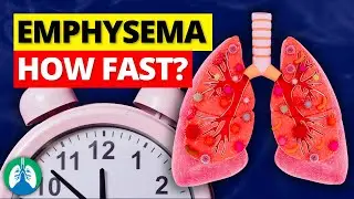 Why Emphysema Progresses Faster Than You Think