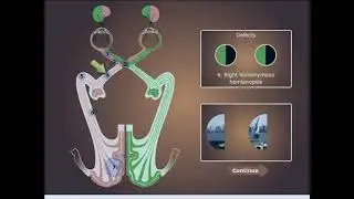 visual pathway and Visual Field Defects