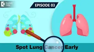 EARLY WARNING SIGNS of Lung Cancer | Spot Lung Cancer Early | Lung Cancer Screening- Doctors Circle