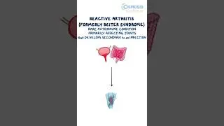 Reactive Arthritis (Reiter Syndrome)