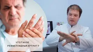 РЕВМАТОИДНЫЙ АРТРИТ l Что это такое? l Симптомы, Пути лечения