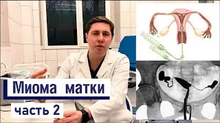 МИОМА матки | ДИАГНОСТИКА | ВСЕ о современных методах диагностики миомы матки