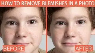 How to Remove Skin Blemishes, Spots, and Other Imperfections from Photos