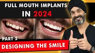 Full Mouth Dental Implants in 2024 - Part 2: The Teeth