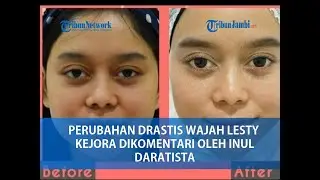 PERUBAHAN DRASTIS WAJAH LESTY KEJORA DIKOMENTARI OLEH INUL DARATISTA