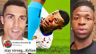 Famous Reaction On Mbappe Breaks Nose & Exits game