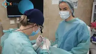 Септопластика в медцентрі K-MED в Києві. Вазотомія. ЛОР-хірург.