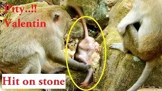 So Pity! Little baby Valentin fall hit on the stone, Poor baby Valentin hurt much