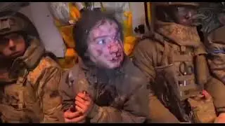 Красота на войне , требует своих жертв 🙄❗️Руснью хотела резать ...😀☝🏻🇷🇺❤️