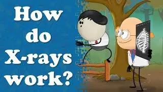 How do X-rays work? | 