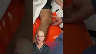 Kneecap Dislocation: Symptoms, Causes, and Reduction Techniques 